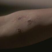Nesset bite