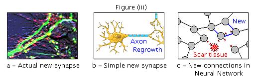 Brain repair figure iii