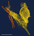 Neutrophil with anthrax copy
