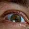 Augen
