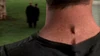 Knowle Rohrer's neck