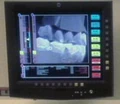 Dental xray.jpg