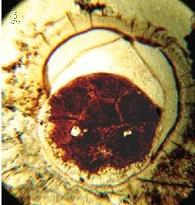 Doushantou Embryo Yinetal2007