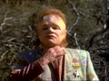 Neelix windpipe.jpg