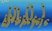 180px-Nematodes_1.jpg