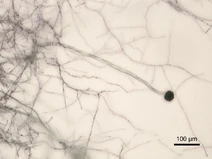 Aspergillus niger Micrograph