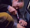 Subdermal scalpel.jpg