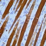 Desmin.skeletal muscle striations