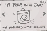 A fetus in a jar