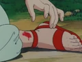 InjuredAnkle