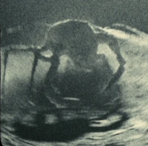 Apollo18bigcrab