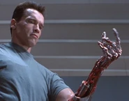 Terminator-arm endo