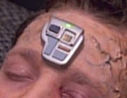 Neural stimulator, 2370s.jpg (31 KB) Neural stimulator, 2370s