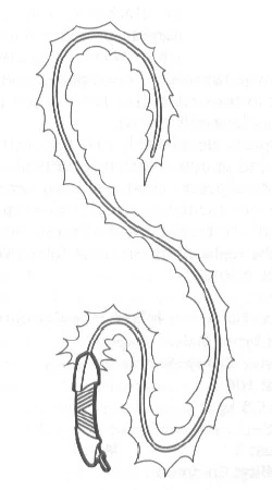 Neuronic Whip