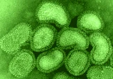 Influenza