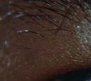 Okularimplantat