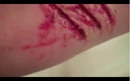 Rake wounds.jpg