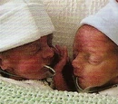 Neonatal Intensive Care Unit