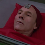 A neural caliper in use on Jean-Luc Picard