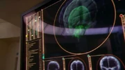 Een medische scan van de Vulcan hersenen.