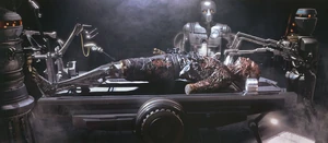 Vader durante sua cirurgia de substituição de membros.