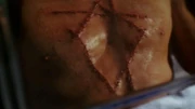 The symbol.
